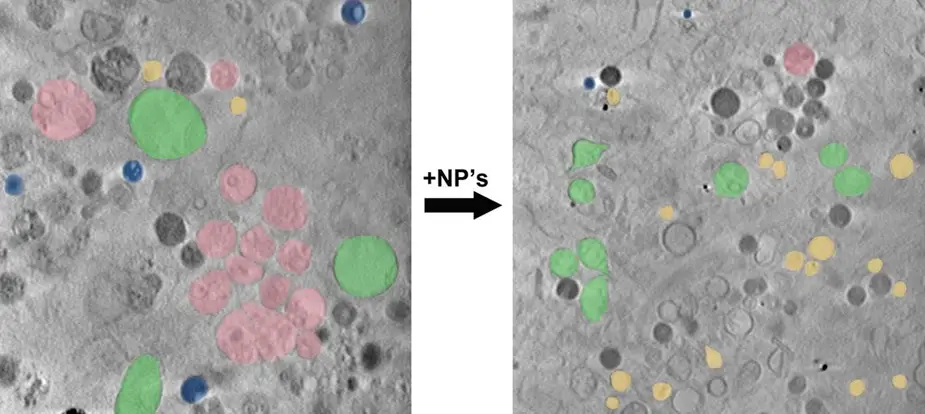 Cell with and without nanoparticles © James McNally/HZB